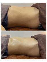 エスエー(SA)/ウエストをしめるのは腸もみ