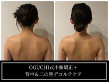 アロラヴィ(AroRavi)/ブライダルエステ