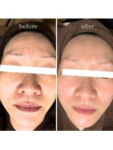 マーギアー(Magier)/ハーブ＋ダーマ　初来店→５回目