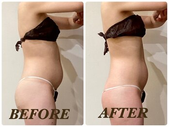 プリマ 栄店(Prima)/【2回施術】　BEFORE＆AFTER