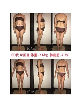シェイプ 浜松本店/60代もダイエット成功