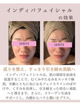 ワン ストレッチ(ONE stretch)/【インディバフェイシャル】