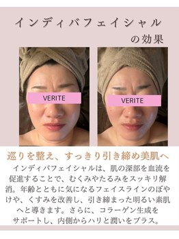 ワン ストレッチ(ONE stretch)/【インディバフェイシャル】