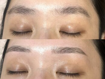 アルム(a'lm)/垢抜けが叶う☆ 顔脱毛/眉WAX