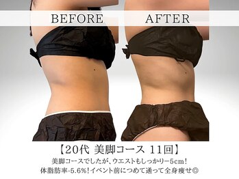 ヨサパーク ククナ 大塚(YOSA PARK kukuna)/痩身/ダイエット/よもぎ蒸し痩身