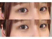 ナッティ(natti)/