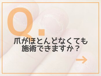 レアム/【Q.５】小さいお爪について。