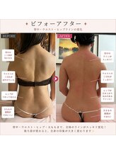 ケイビューティ(k-beauty)/毛穴/フェイシャル/小顔コルギ