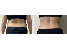 パーフェクトボディ(PERFECT BODY)/優秀賞☆前後の変わりがすごい！