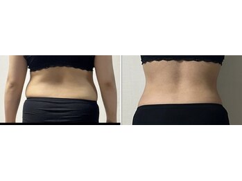 パーフェクトボディ(PERFECT BODY)/優秀賞☆前後の変わりがすごい!