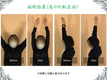 ボディ リセット アンド デザイン(Body Reset & Design)/【施術例】ビフォーアフター