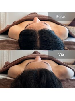 トータルボディケアサロン松濤/ビフォーアフター