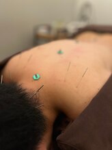 ハリマジック 代官山(HARI MAGIC)/【代官山/鍼灸/美容鍼】