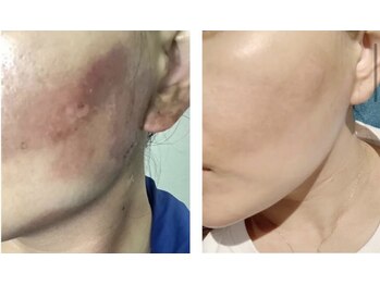 モガナ(mogana)/炭酸パック/エナジーケア