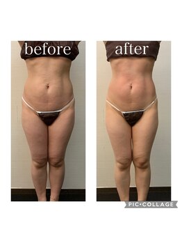 ソリス ビューティー(SOLIS BEAUTY)/充実痩身