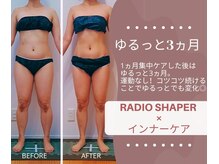 りもあず(ReMore-S)の雰囲気（脂肪細胞燃焼＆分解◆ダイエット【痩身/美脚/くびれ/腰肉撃退】）