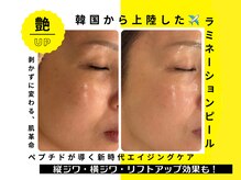 ナチュリフィール(naturefeel)