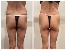 ミ ライト(m light)/