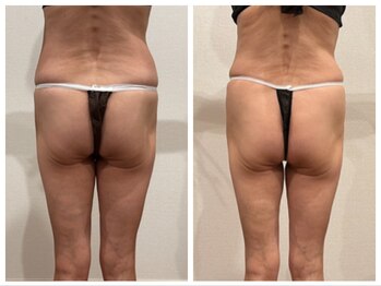 ミ ライト(m light)/