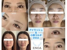 エノア(ENOA)