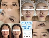 エノア(ENOA)