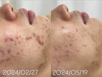 アンリミット 渋谷宮益坂店(Une limit)