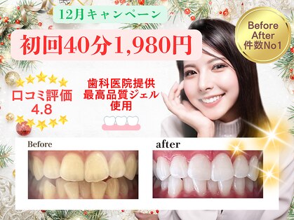 ホワイトニングショップ 鳥栖店の写真