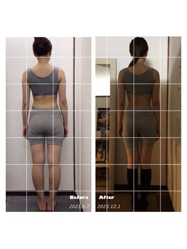 Salon Now or Never/小顔、骨盤矯正、腸揉み、リンパ