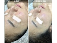 アイアール(ir)/