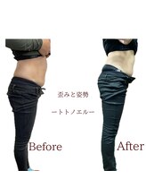 整体院トトノエル 西川原院/Before→After 
