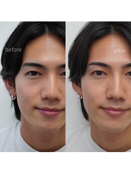 ワクシー 恵比寿店(WAXYYY.)の写真/SNSでも話題沸騰◆今やりたい眉毛No1【ハリウッドブロウリフト】発祥サロン！眉のお悩み一気に解決！