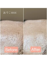 プリュネル(prunelle)/ポイントワックス(おでこ)