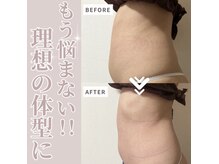 オレンジ(Orange)/