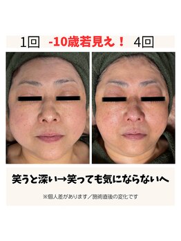 トータルビューティー雅/＜小顔になる★☆＞