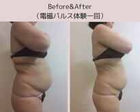 Hb 与野
