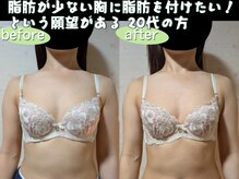 スノードロップ(snowdrop)/20代の方のバストアップ