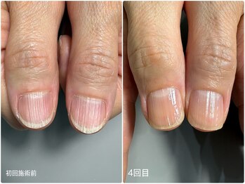 地爪育成