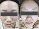 パルサロン(palsalon.)の写真