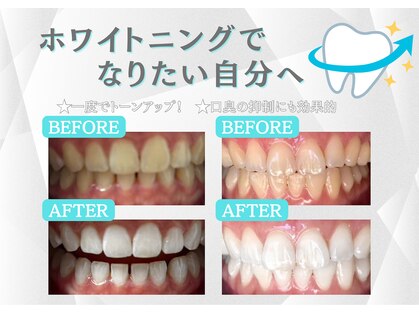 シロサロン(silo salon)の写真
