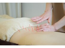 アンドコンディショニングルーム(&conditioning room)の雰囲気（『鍼灸マッサージ』当店の鍼灸はソフト♪初めてでもお気軽に♪）