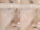 アリス 心斎橋店(alice)の写真