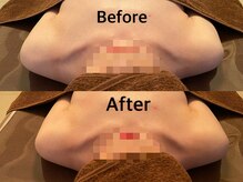 整顔整頭/【巻き肩・肩こり改善】