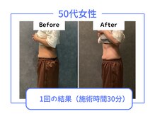 ビオラス 高崎店/一回での変化