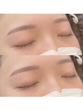 ハプム 水戸(HAPUM)/自然な平行デザイン