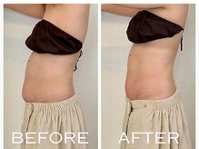 ココロミ(cocoromi)/ハイパーナイフ