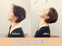 ユアーズ 京都 四条大宮(YOURS)/首・肩の痛み解消！