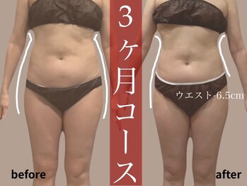 モア 多治見店(MORE)/お客様ビフォーアフター