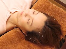 松尾美容鍼灸×整体 香椎/施術風景です