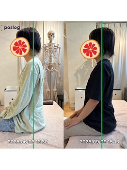 グレフル鍼灸接骨院 整体院 心斎橋/整体/肩こり/マッサージ/腰痛