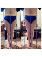 ナニ(nani)/リンパマッサージ＋骨盤矯正